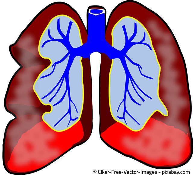 Atemwegserkrankungen und Husten können eine Folge von Hausstaub sein